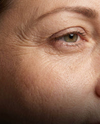 Slow Aging